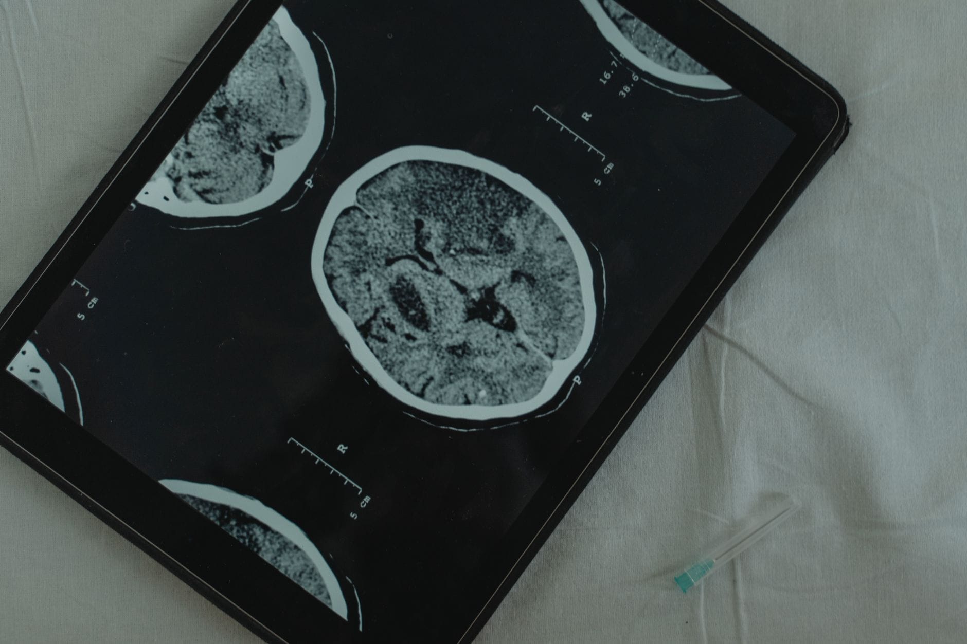 Zbliżenie na tomografię mózgu na tablecie i igłę medyczną obok